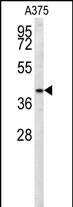 SLC35B2 Antibody in Western Blot (WB)