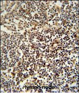 LAPTM5 Antibody in Immunohistochemistry (Paraffin) (IHC (P))