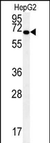 KEAP1 Antibody in Western Blot (WB)