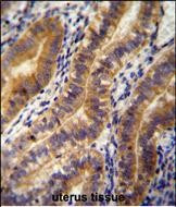 Angiopoietin 2 Antibody in Immunohistochemistry (Paraffin) (IHC (P))