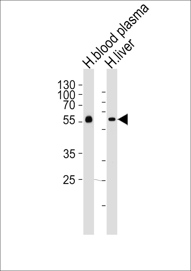 Fetuin A Antibody in Western Blot (WB)