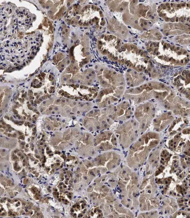 Cyclin Y Antibody in Immunohistochemistry (Paraffin) (IHC (P))