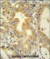 DcR3 Antibody in Immunohistochemistry (Paraffin) (IHC (P))