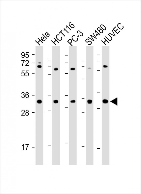 DcR3 Antibody in Western Blot (WB)