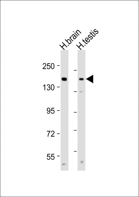 MRP3 Antibody in Western Blot (WB)