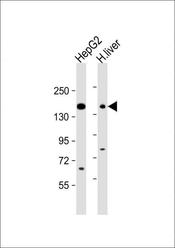 MRP3 Antibody in Western Blot (WB)