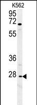 CXCR3 Antibody in Western Blot (WB)