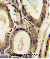 CCL4 Antibody in Immunohistochemistry (Paraffin) (IHC (P))