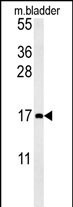 CCL4 Antibody in Western Blot (WB)