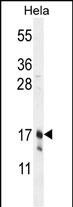 Claudin 7 Antibody in Western Blot (WB)