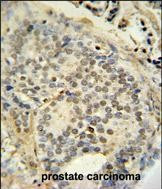 FUS Antibody in Immunohistochemistry (Paraffin) (IHC (P))