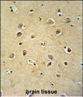 GABRG2 Antibody in Immunohistochemistry (Paraffin) (IHC (P))