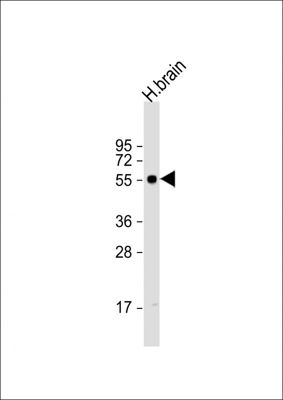 GABRG2 Antibody in Western Blot (WB)