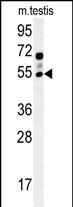 GABRG2 Antibody in Western Blot (WB)