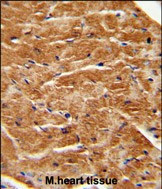 KGF Antibody in Immunohistochemistry (Paraffin) (IHC (P))