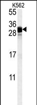 KGF Antibody in Western Blot (WB)