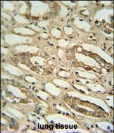 GGTLC2 Antibody in Immunohistochemistry (Paraffin) (IHC (P))