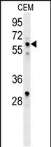 IKAROS Antibody in Western Blot (WB)