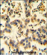 KIAA0090 Antibody in Immunohistochemistry (Paraffin) (IHC (P))