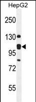 KIAA0090 Antibody in Western Blot (WB)