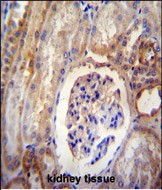 DYNLRB2 Antibody in Immunohistochemistry (Paraffin) (IHC (P))