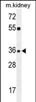 KLF14 Antibody in Western Blot (WB)