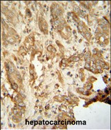 NAT14 Antibody in Immunohistochemistry (Paraffin) (IHC (P))