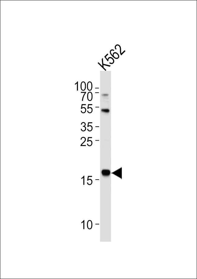 NAT14 Antibody in Western Blot (WB)