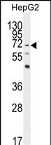 LRRC33 Antibody in Western Blot (WB)