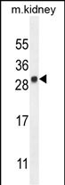 LYPD4 Antibody in Western Blot (WB)