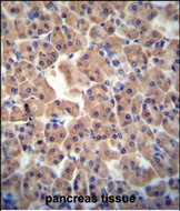 CTU1 Antibody in Immunohistochemistry (Paraffin) (IHC (P))