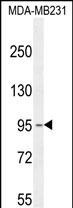 KCNT2 Antibody in Western Blot (WB)