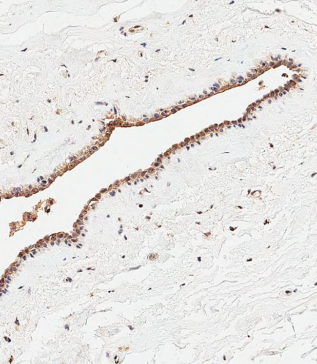 CEPT1 Antibody in Immunohistochemistry (Paraffin) (IHC (P))