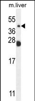 NEU4 Antibody in Western Blot (WB)