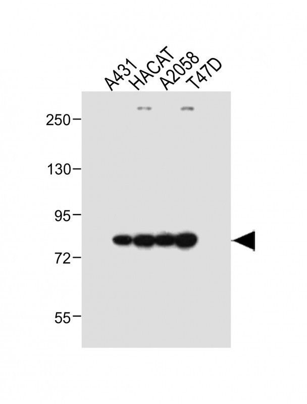 ALOXE3 Antibody in Western Blot (WB)