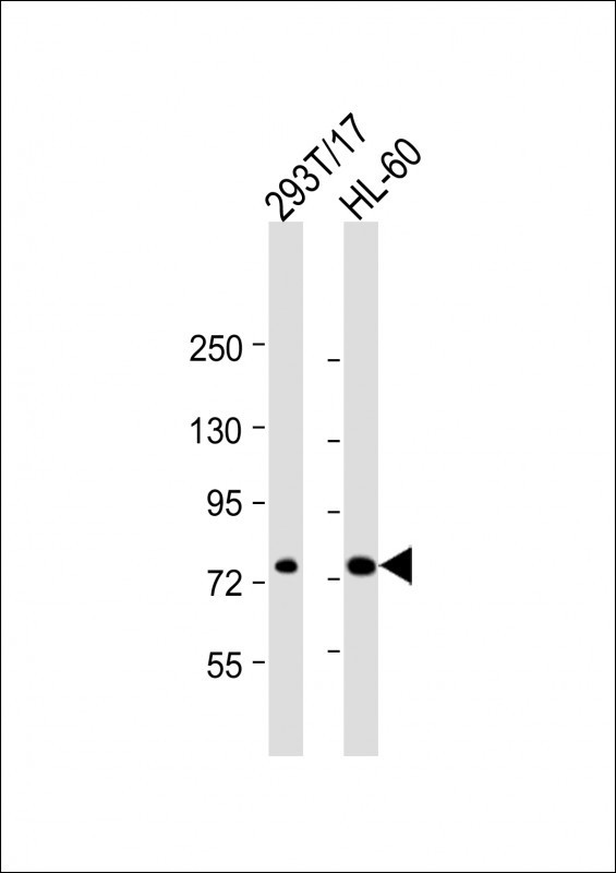 ABCD1 Antibody in Western Blot (WB)