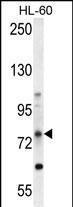 ABCD1 Antibody in Western Blot (WB)