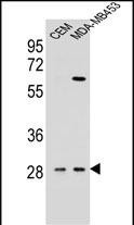 IL-12 p40 Antibody in Western Blot (WB)