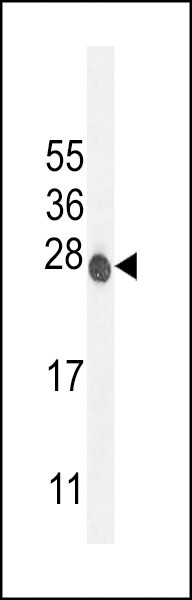 ATP6V0C Antibody in Western Blot (WB)