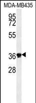 EXO5 Antibody in Western Blot (WB)