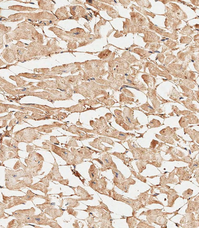 Collagen V Antibody in Immunohistochemistry (Paraffin) (IHC (P))