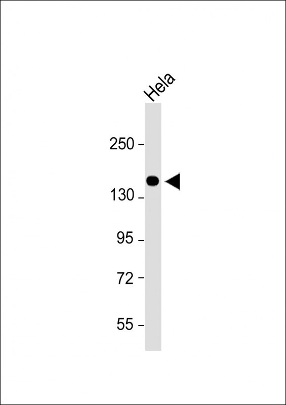 Collagen V Antibody in Western Blot (WB)