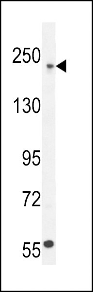 Collagen V Antibody in Western Blot (WB)