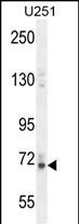 Vitrin Antibody in Western Blot (WB)