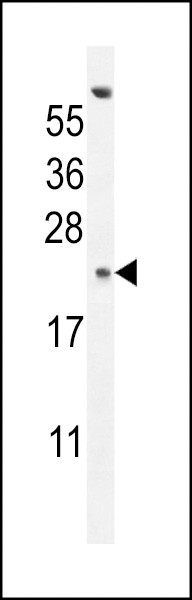 GAGE13 Antibody in Western Blot (WB)