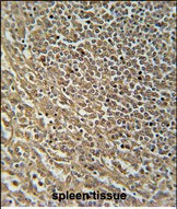 RASAL3 Antibody in Immunohistochemistry (Paraffin) (IHC (P))