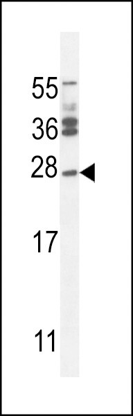 JOSD2 Antibody in Western Blot (WB)