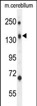 CD109 Antibody in Western Blot (WB)