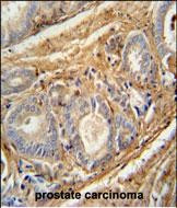 PCOTH Antibody in Immunohistochemistry (Paraffin) (IHC (P))