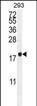 PCOTH Antibody in Western Blot (WB)